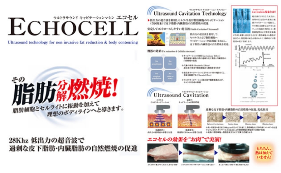 キャビテーションの詳細